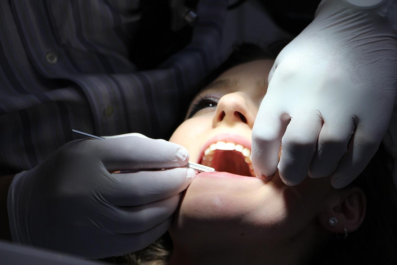 Chirurgiczne usuwanie zębów